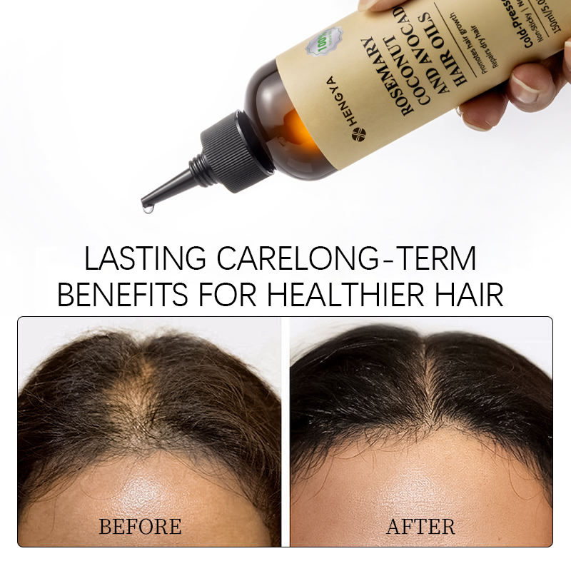 图片[5]-OEM ODM Private Label Organic Hair Care Essential Oil Honey Nourishing Scalp Enhances Hair Smoothness Made in China