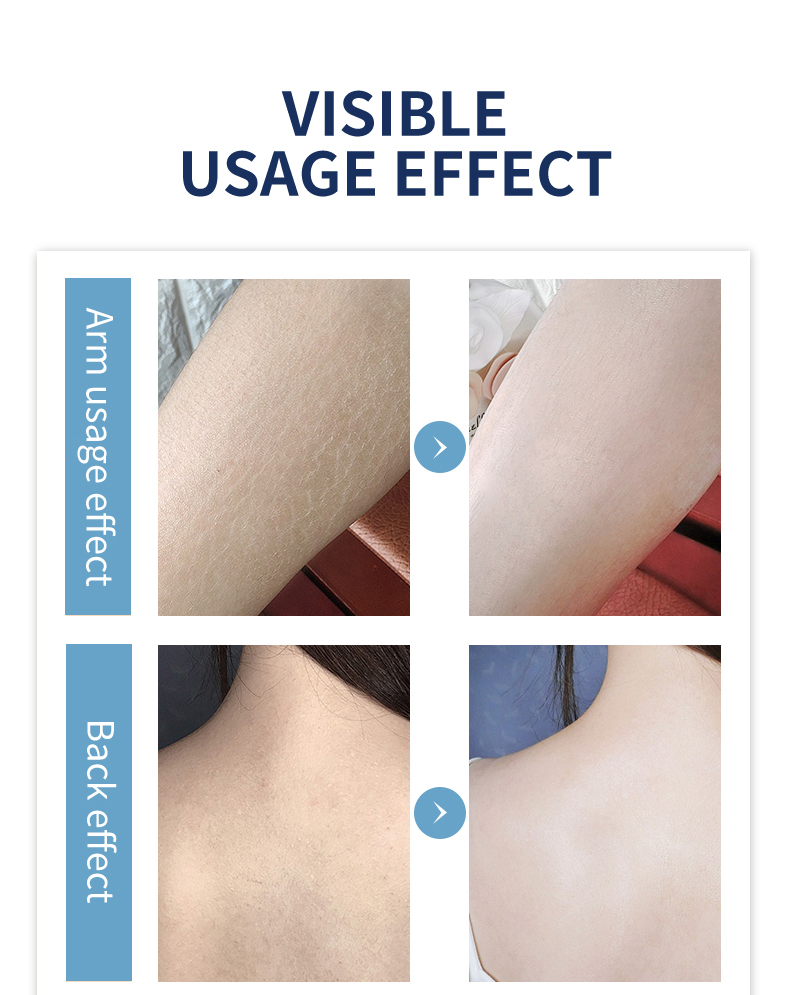 图片[6]-Vitamin B5 Lubricating Moisturizing Body Lotion Cream OEM ODM Custom Skincare Manufacturer Private Label Logo Formula Customization Deep Hydration for Dry and Sensitive Skin