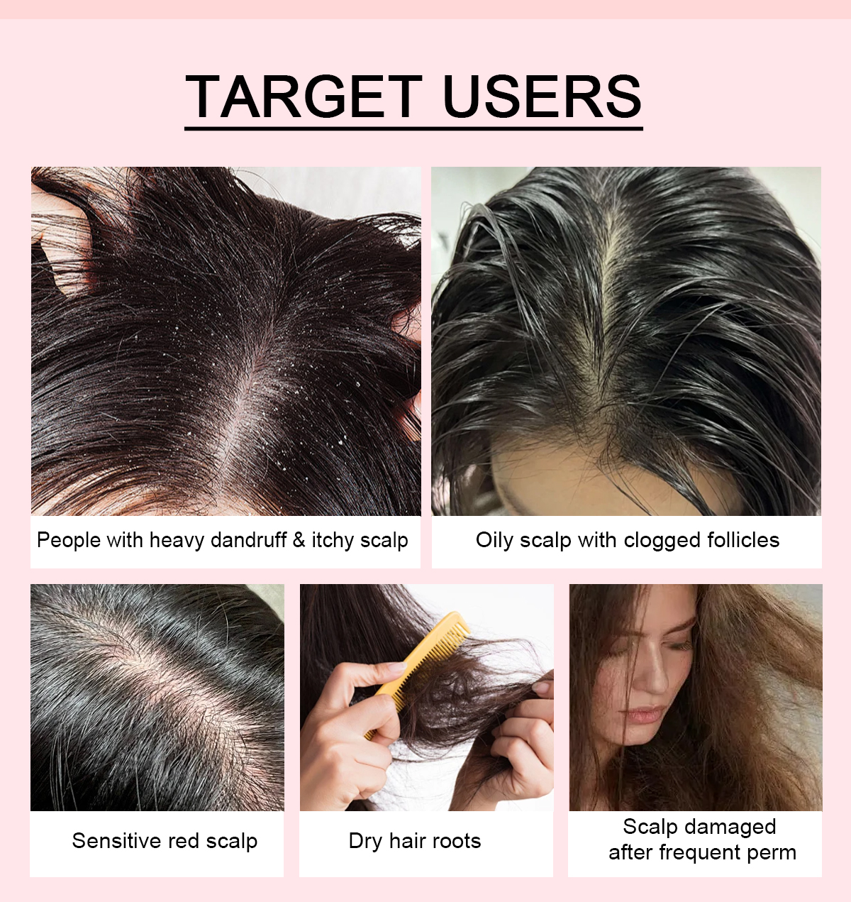图片[5]-Clarifying Anti Dandruff Shampoo Soothes Itchy Scalp and Balances Sebum
